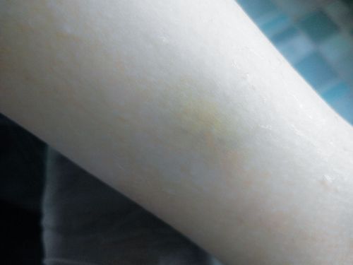 胳膊上出现了一块黄色带绿色的痕迹 像是撞到哪里了 可是又没碰到哪啊