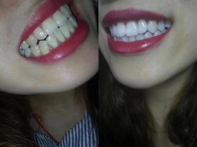 广东完美大使美牙招商总部