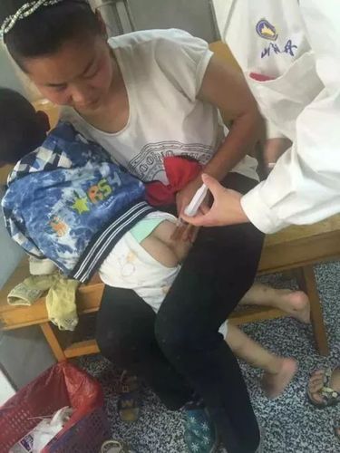 山海丹鱼金灌肠退热合剂经直肠给药治疗小儿外感发热