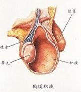 傻眼了,好不容易盼来带把儿的宝宝,竟然阴囊肿大