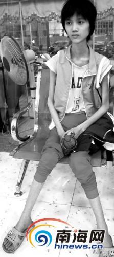 半年多前的梁参骨瘦如柴