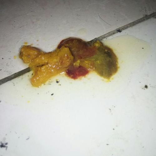 宝宝这两天拉肚子,拉出血了怎么回事?