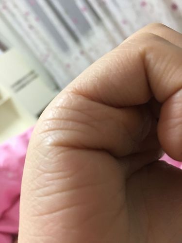 子女线分叉是什么意思?