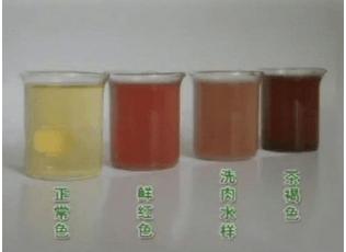 你的尿液的4个症状,反应你的肾在亮红灯_搜狐健康