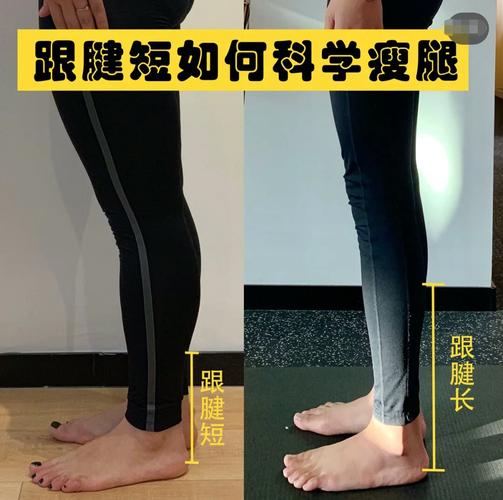 如果我的跟腱短,腿型不好看,应该怎样瘦腿呢?今天教你