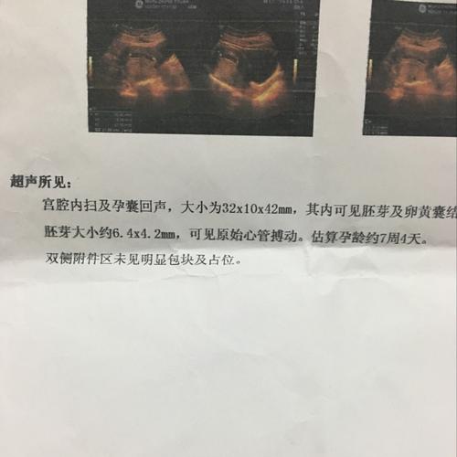 孕囊说是32,10,42mm.为什么不> 帖子详情