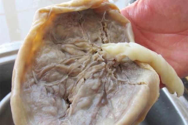 产妇吃掉自己的胎盘,宝宝两次