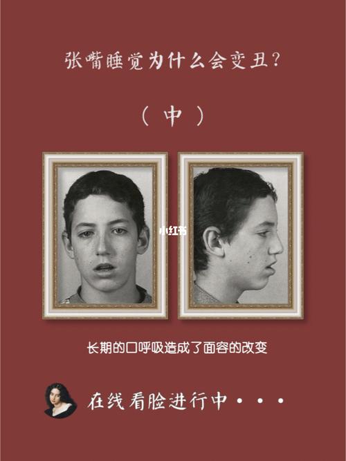 张嘴睡觉为什么会变丑呢?(中)_资讯_知识科普