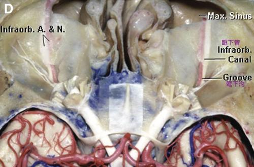 脑血管解剖学习笔记第15期:眶下动脉