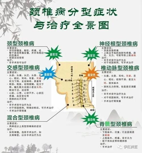每天用手按压这个部位,对颈椎病有一定的疗效.