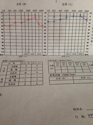 纯音测听检查报告求解答,左耳有问题吗?