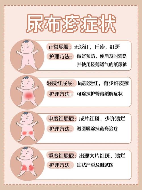 尿布疹_菠萝_bobdog怎么样_夏天去哪玩_过敏_测评_手机_红屁股_纸尿裤