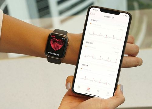 apple支援越狱后国行版applewatch激活ecg功能教程