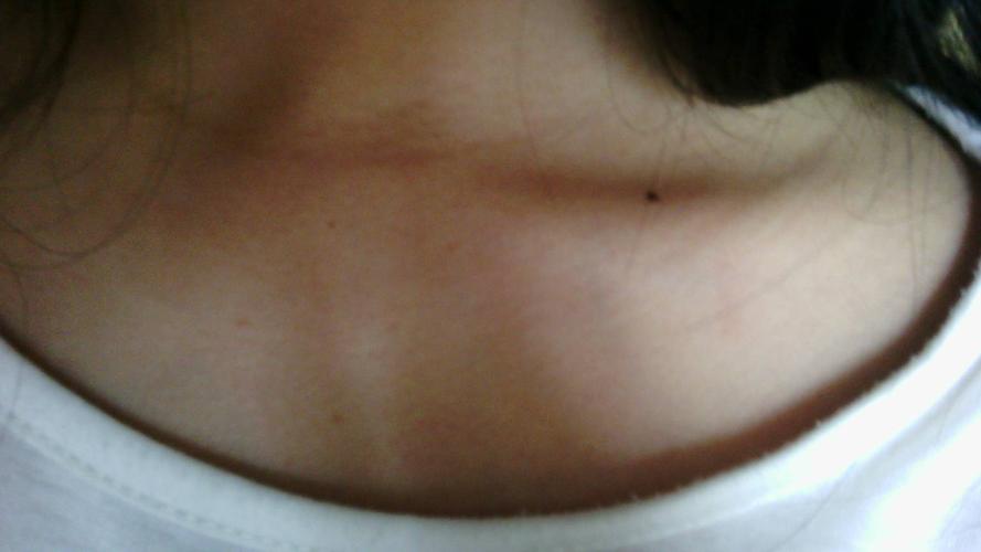 锁骨左边一颗痣代表什么