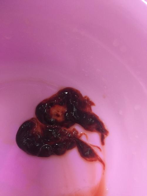 6月27号开始药流,29号吃的最后三片,药流没流掉,今天中午12:00又开始