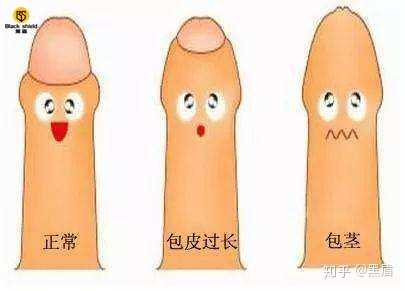 我20了阴茎短小怎么办求助