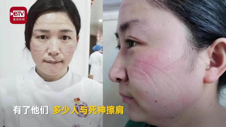 抗疫医护满是勒痕的笑脸 战胜"新冠"的勇气与希望