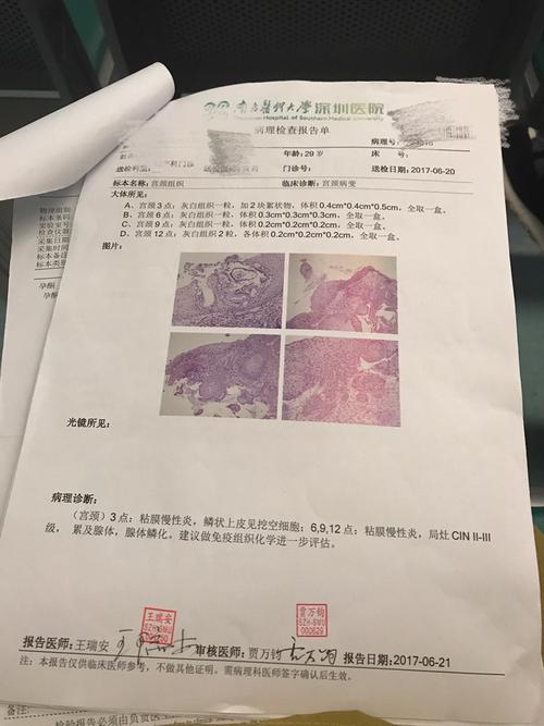 备孕1年半一直未孕,准备做人工授精,前期检查发现宫颈