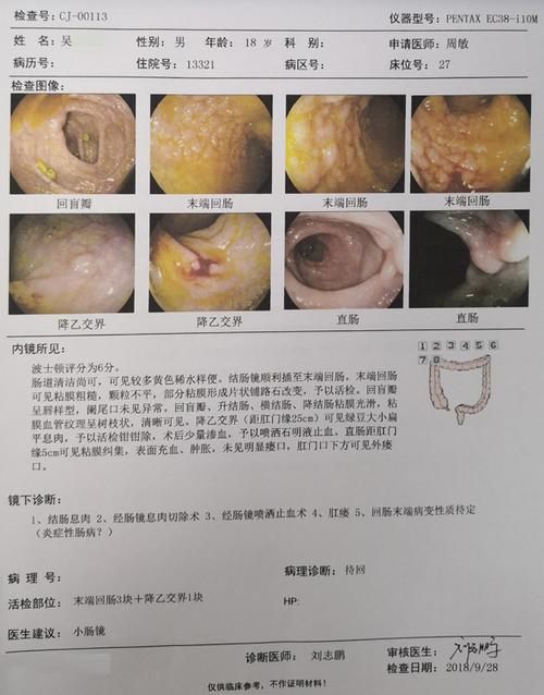 2018年9月28日, 一位有肛瘘症状的患者在周敏医生的建议下,到我院
