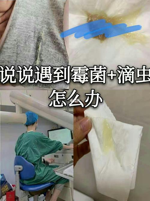 说说遇到霉菌 滴虫怎么办 女生那些不可告人的秘密|我