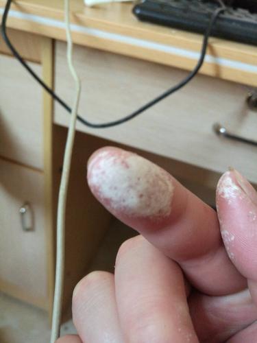 手碰到双氧水手指就变成这样了.怎么办