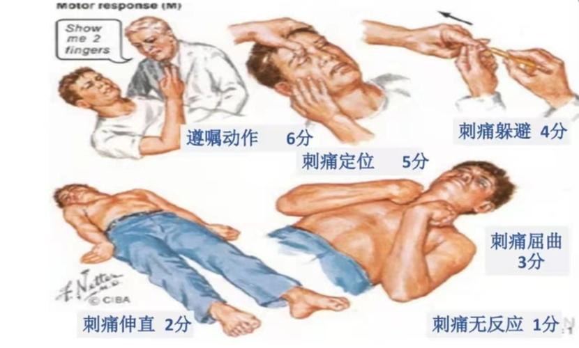 改良glasgow昏迷评分