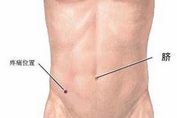 慢性阑尾炎手术费用是多少?