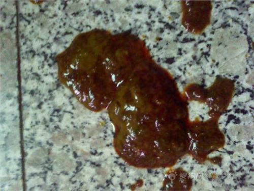 大便带血图片分解