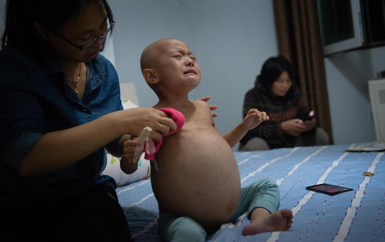 直击:4岁女童"怀孕十月",5张照片道出心碎真相,张张泪目!-手术台