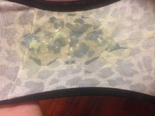白带呈脓状,而且比较粘稠,量大,呈绿色,希望得到帮助