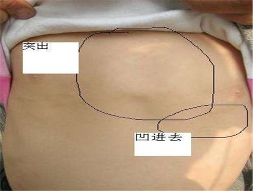鸡胸
