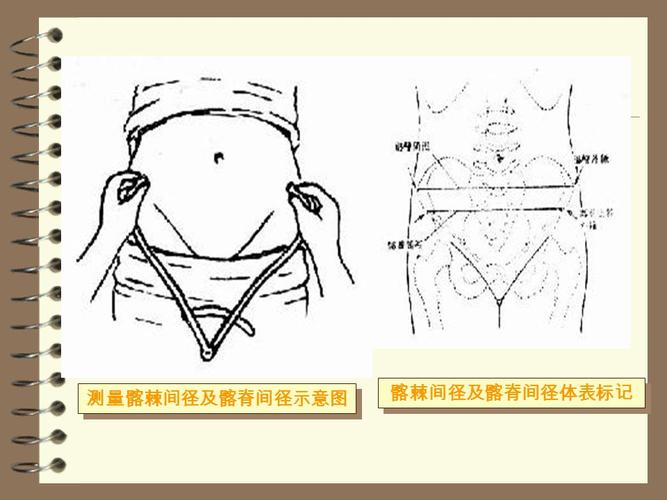 骨盆测量: 4 外测量: – 髂棘间径:孕妇仰卧,用骨盆测量尺测两