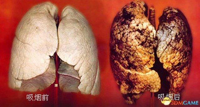 吸烟有害健康吸烟人的肺对比图片让人触目惊心