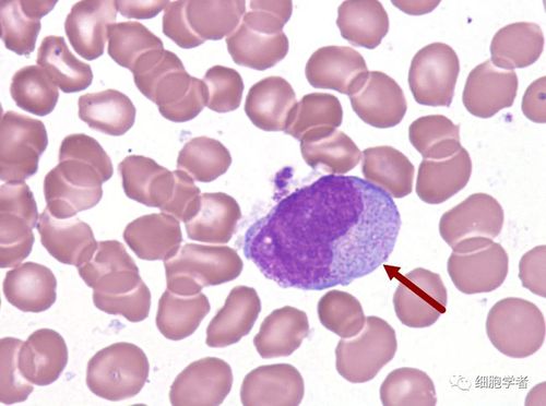 幼稚单核细胞   16