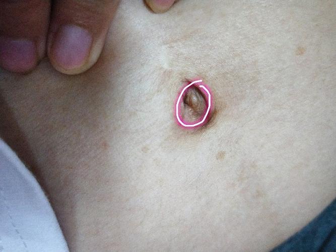 只看该作者楼主 小小小小夏天天 怀孕27周重庆市 孕19周肚脐眼中间起