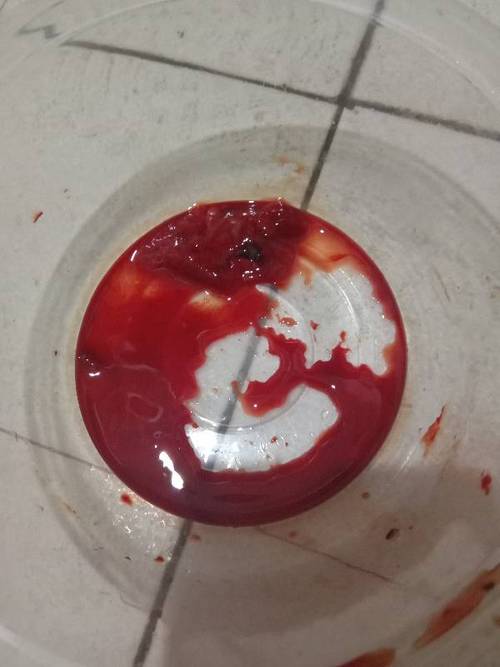 这个是孕囊吗?本人怀孕48天,今天就流下了这个?不知道