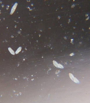 鱼缸子里有白色的线虫怎么去除