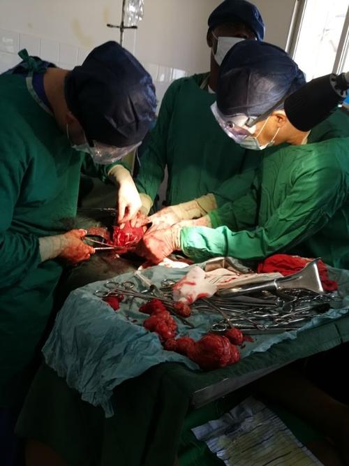 第19批姆点妇科手术之2-多发性子宫肌瘤剔除术