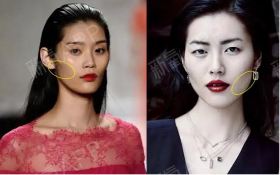 颧骨颧弓是如何影响脸型的?