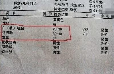 (大便常规检查报告▲)