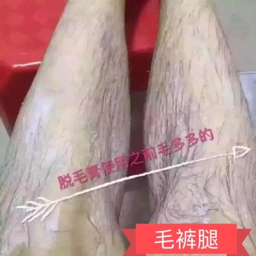 告白毛裤腿 143       赞                   评论              2年