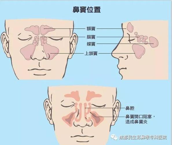 01, 鼻窦在哪里?其作用有哪些?