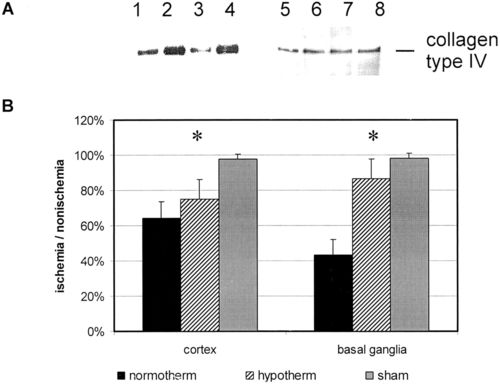 mild to moderate hypothermia prevents microvascular basal lamina