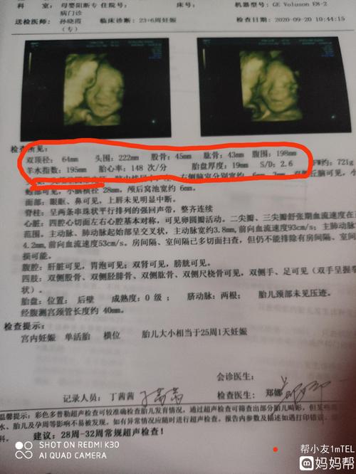 前几天刚做的四维不知道男孩女孩,大家帮我