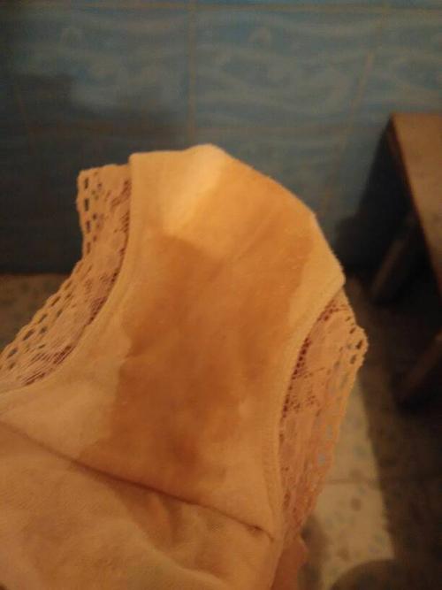 内裤整天湿湿的还有臭味,就好像来月经一样一股一股的,还有像豆腐渣一