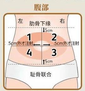 生殖科打针那些事