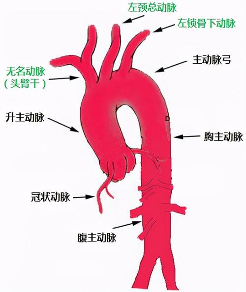 病例精选 | 体外开窗自制内嵌式三分支支架全腔内修复