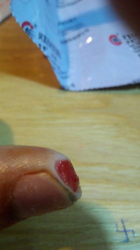 楼主大概五天前不小心把手指上的肉割掉一块,去医院包扎过了,一共换了