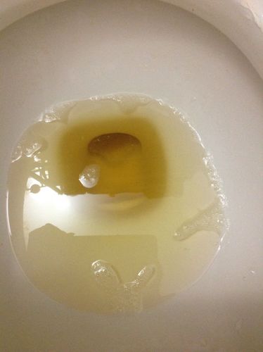 这是蛋白尿吗?刚开始很多泡沫,10分钟后才慢慢减少的照片里的数量.