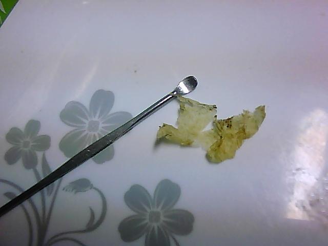 世界上最大的耳屎,我耳朵里扣出来的,这是展平之后的样子.